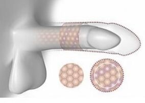 Increased penis in the notebook